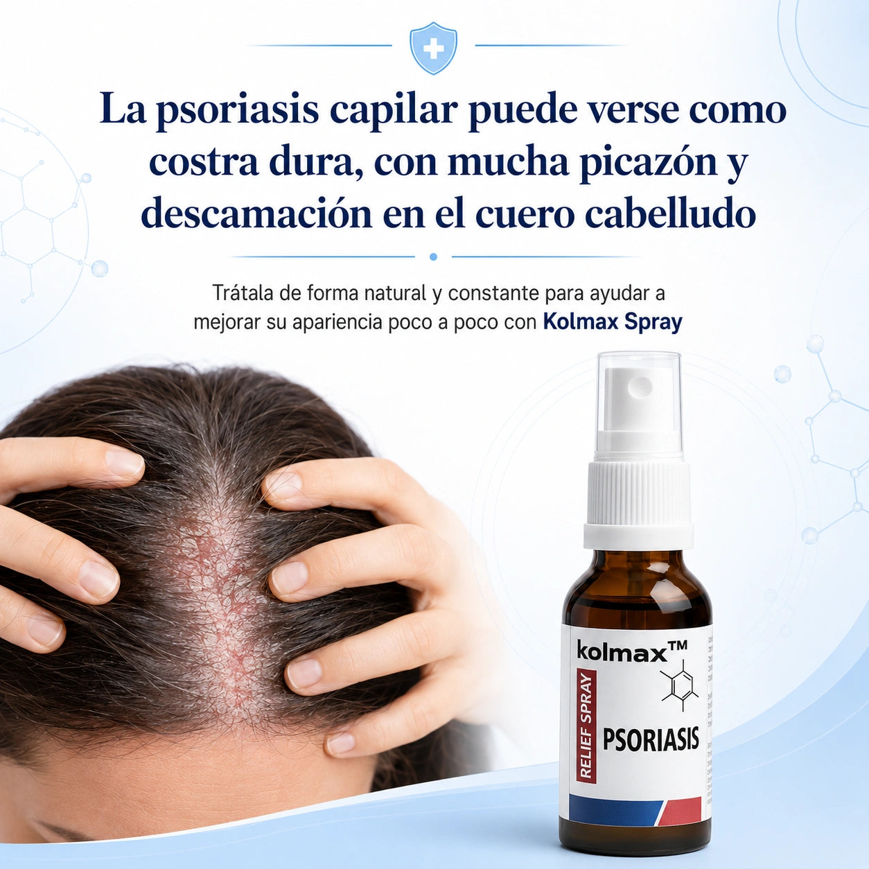 Spray para la psoriasis capilar (30ML) - Desaparece la caspa inflamatoria en el cuero cabelludo desde los 7 días de uso