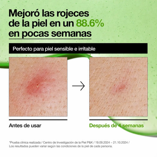 Anua® Ácido Azelaico 10% de 30ml - Disminuye las rojeces en tu piel causadas por irritación y post-acné